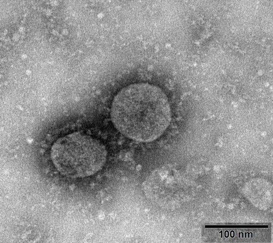 중국 바이러스 질병 통제 예방 연구소가 제공한 신종코로나 바이러스 현미경 사진.